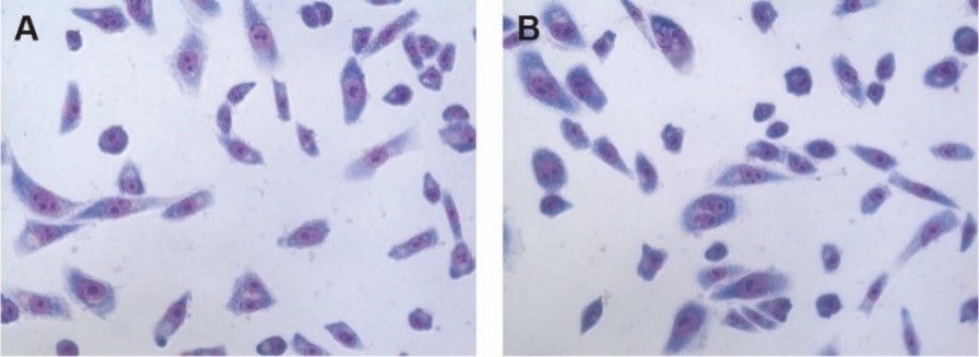 亚甲基蓝染色酵母细胞图片